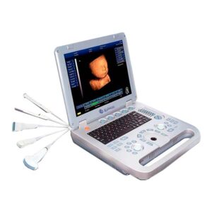 Obstetric ultrasound 3D4D GYN YR05147